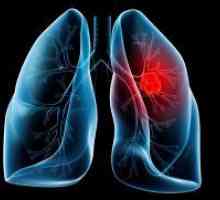 Tratamentul de remedii populare de cancer pulmonar