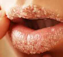 Se tratează buzele crapate acasă