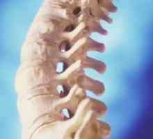 Metastazele la nivelul coloanei vertebrale