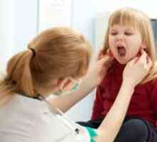 Mononucleoza la copii - Tratamentul