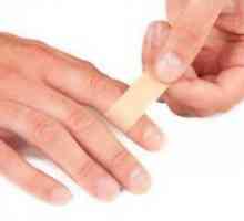 Un abces pe deget - Tratamentul