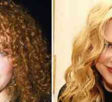 Nicole Kidman - atât înainte, cât și după plastic