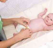 Omfalita la nou-nascuti