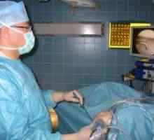 Chirurgie pe meniscul genunchiului