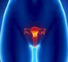 Tumora uterin - simptome