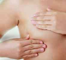 Tumori de sân la femei - Simptome