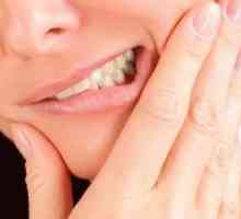 Parodontită acută