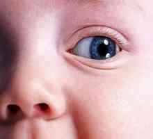 Umflarea ochii copilului