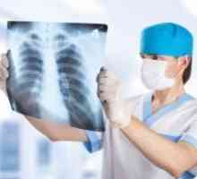 Edemul pulmonar - Simptome