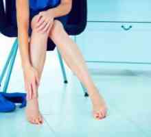 Umflarea picioarelor - cauza femeilor