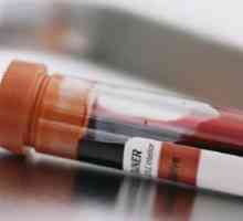 Creșterea de insulină în sânge - Cauze