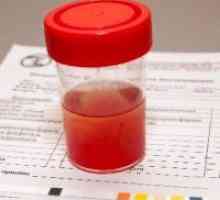 Creșterea de celule roșii din sânge în urină
