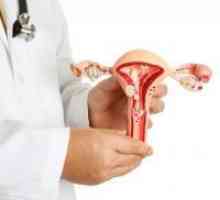 Boala precanceroase cervicale