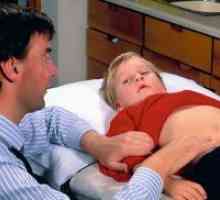 Semne de apendicita la copii