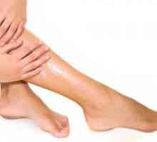 Prevenirea venelor varicoase la nivelul picioarelor