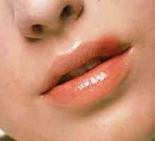 Rece pe buze: secretele de eliminare eficientă și rapidă
