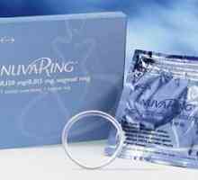 NuvaRing contraceptiv