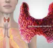 Puncția tiroidiană