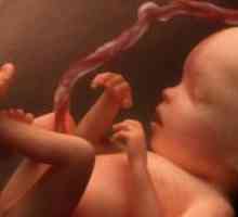 Cordonul ombilical la nou-nascuti