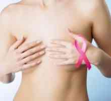 Cancerul de sân - Simptome