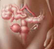Cancerul ovarian - Simptome