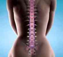 Cancer al coloanei vertebrale - primele simptome
