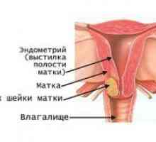 Cancerul de col uterin - semne