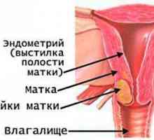 Cancerul de col uterin - Simptome, cauze, tratament!