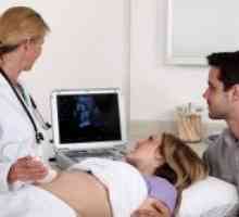Discrepanța dintre simfiza pubiană în timpul sarcinii
