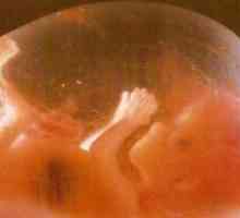 Săptămâna dezvoltării fetale de săptămâni de sarcină