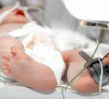 Resuscitarea neonatală