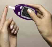 Diabet - simptome la femei