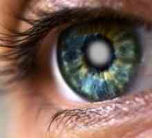Simptomele de cataractă în stadiile incipiente