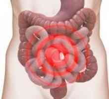 Sindromul de colon iritabil - Simptome