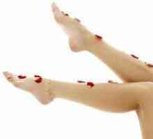 Venele picioarelor Scleroterapia