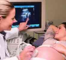 De câte ori se poate face cu ultrasunete în timpul sarcinii?