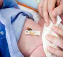 Cum se vindeca buricul unui nou-născut?
