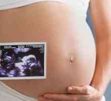 Screening-ul în timpul sarcinii
