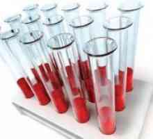 Compatibilitatea grupelor sanguine pentru concepție