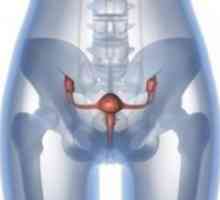 Aderențele în trompele uterine - Tratamentul