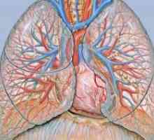 Stenoză pulmonară