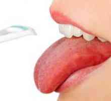 Aftele pe limba - tratament la adulți