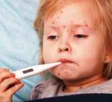 Streptoderma la copii - tratament de droguri