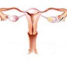 Structura de ovar