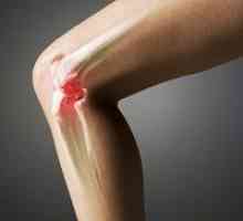 Exerciții artritice pentru genunchi