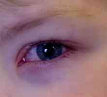Copilul are ochii roșii, de ce și ce să fac?