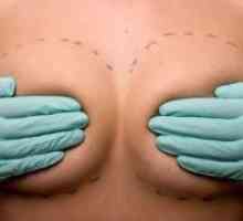 Mastectomie