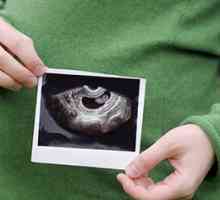 Uzi in timpul sarcinii: cronologia