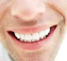 Tipuri de proteze dentare