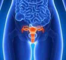 Endometrioza interna - Tratamentul